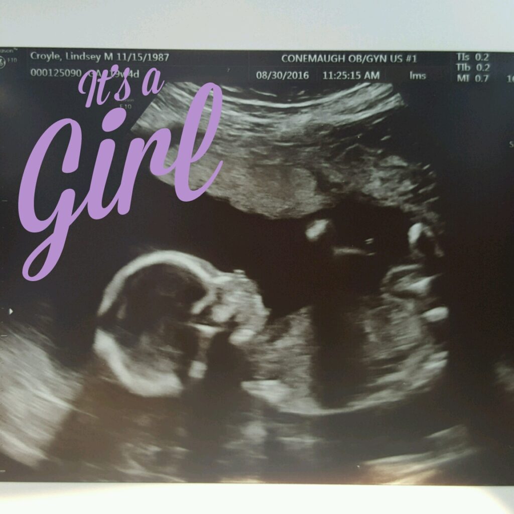 its a girl